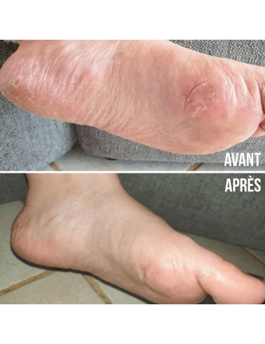 CHAUSSONS DE SOIN hydratant 2 x 15ml Même Cosmetics